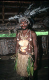 Bilas Melomelo Tribal Bailer, Cymbium Shell Called Gam by the Primitive Mendi Tribe’s “Big Men” that wear them as forehead decorations, & used them also as Currency, Bride Price, etc.. Collected in late 1900’s, Southern Highlands, Papua New Guinea BAL3